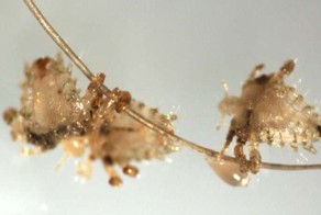 Взгляните на собственное тело под микроскопом