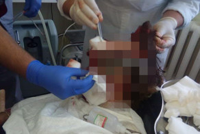 На Камчатке медведь растерзал туристку из Франции