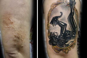 Бесплатное тату вместо шрама