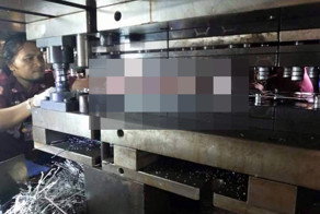 Лишился обеих рук