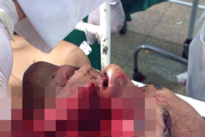 Ковбой получил копытом в лицо