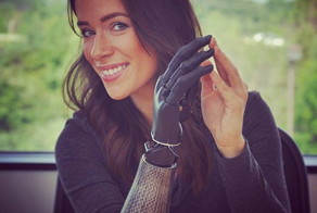 Девушка с бионической рукой