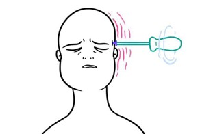 Что ни день, то мигрень: наша головная боль наглядно