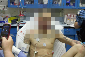 Нож застрял в лице