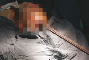 Арматура прошла через голову рабочего