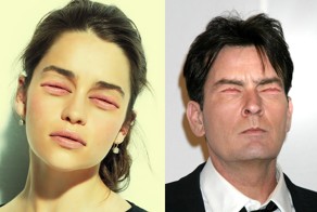 Глазоротые знаменитости