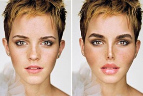 Если бы знаменитости делали операции у дешёвых пластических хирургов