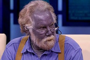 7 самых странных болезней мира, не поддающихся объяснению