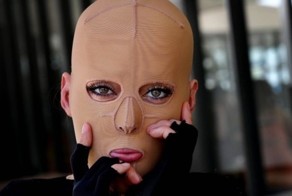 Жизнь без лица закончена: австралийка сняла маску, которую носила 2,5 года