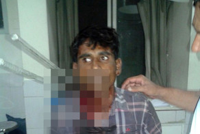 Мотоциклиста насквозь проткнуло арматурой