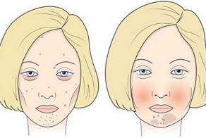 4 продукта, которые портят ваше лицо