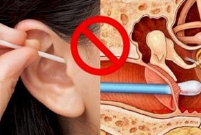 Дешево и сердито - Чистим уши правильно