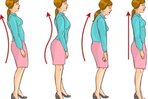 Нарушения осанки и упражнения, которые помогут их исправить