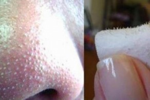 Как убрать черные точки на носу в домашних условиях 