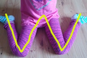 Почему ребенку нельзя сидеть в позе лягушки