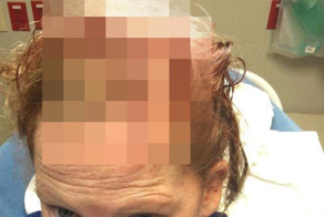 Девушка очень неудачно упала с ховерборда