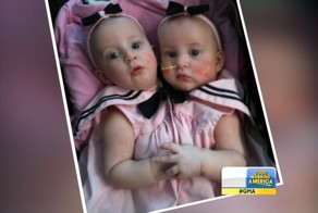 Врачи не давали шансов этим малышкам, но материнское сердце не соглашалось с ними