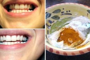 Если вы смешаете эти 3 ингредиента, то получите отбеливающую зубную пасту