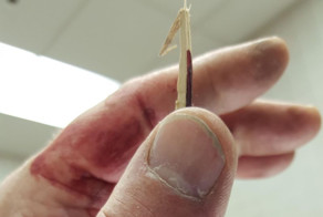 Мужик подцепил занозу на пилораме