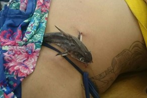 Маленький сомик впился в живот девушки