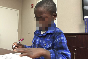 Дикие шимпанзе изуродовали лицо мальчика