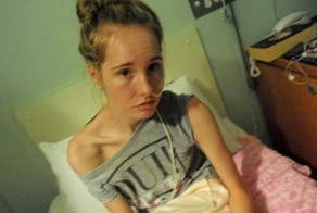 До и после: история анорексички