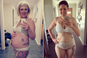 Девушка, страдающая от болезни Крона, ведёт блог со своими селфи в поддержку других больных