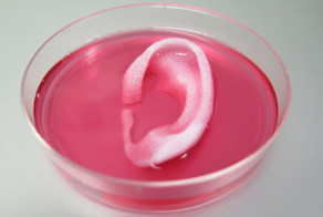 Учёные распечатали на 3D-принтере человеческое ухо для трансплантации