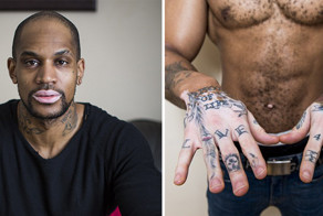 Мужчина с витилиго едва не покончил с собой из-за травли, но дал отпор ненавистникам и стал моделью