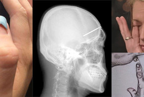 Вот вам 18 самых мерзких картинок в интернете, и не говорите, что вас не предупреждали