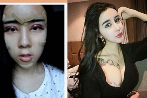 15-летняя китаянка перекроила тело и лицо ради потерянного бойфренда