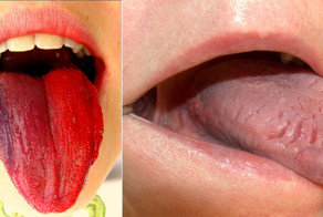 Взгляните на свой язык и вы узнаете  о состоянии ваших внутренних органов