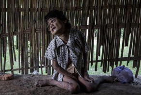 Жизнь людей с психическими отклонениями в Индонезии