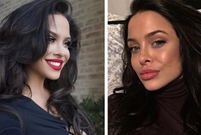 Американская модель становится всё больше похожа на Анджелину Джоли 