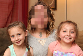 Матери с редким заболеванием, вшили под кожу воздушные шары