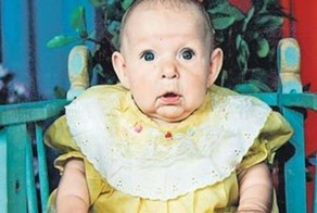 Девушка с лицом бабушки вышла замуж и родила сына