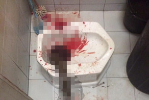 Питон забрался в унитаз и укусил тайца за пенис