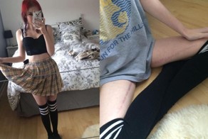 Девушка поделилась фотографиями последствий болезни Крона, чтобы вдохновить других