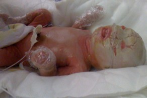 Кожа мальчика растет быстрее обычного