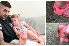 Всего за 30 минут босоножки счесали ноги ребенка в кровь