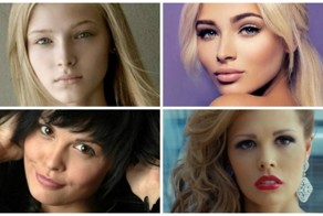 11 российских красавиц до и после пластики