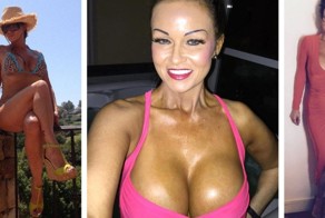 52-летняя британка с помощью пластики помолодела на два десятка лет