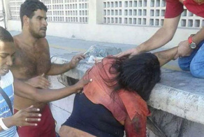 Женщина потеряла руку, пытаясь запрыгнуть в поезд