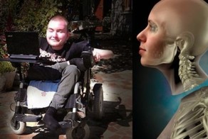 Шок: российского пациента готовят к первой в мире пересадке головы!