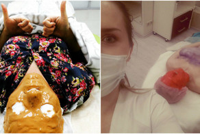 На пути к красоте все средства хороши!