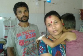 У индийского мальчика вытекли глаза