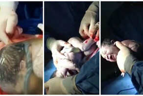 Как выглядит "рождение в рубашке"