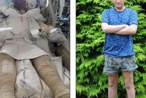 Жуткая аллергия на лекарственный препарат