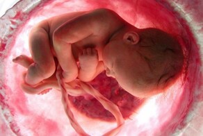 Новый тренд от молодых мамочек: Хенд-мейд украшения из пуповины