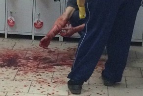 В Нижнекамске магазинный вор вскрыл себе вены
